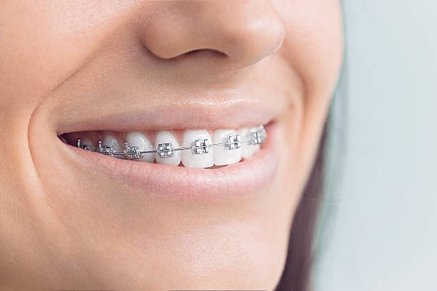 Best Dentures (Full and Partial)  in Sughter, LA